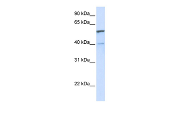UGT1A6 Rabbit Polyclonal Antibody