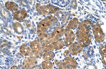 BHMT Rabbit Polyclonal Antibody