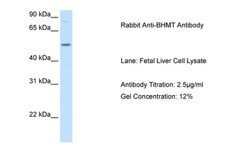 BHMT Rabbit Polyclonal Antibody