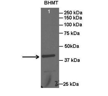 BHMT Rabbit Polyclonal Antibody