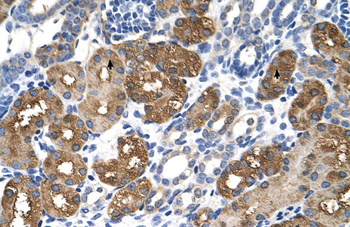BHMT Rabbit Polyclonal Antibody