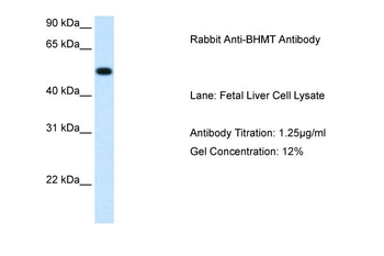 BHMT Rabbit Polyclonal Antibody