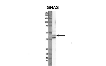 GNAS Rabbit Polyclonal Antibody
