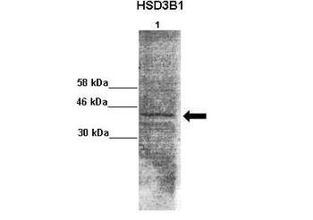 HSD3B1 Rabbit Polyclonal Antibody
