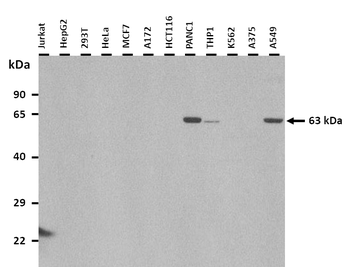 CES1 Rabbit Polyclonal Antibody