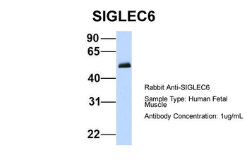 SIGLEC6 Rabbit Polyclonal Antibody