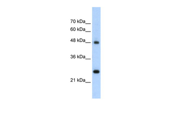 CHGA Rabbit Polyclonal Antibody
