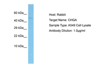 CHGA Rabbit Polyclonal Antibody