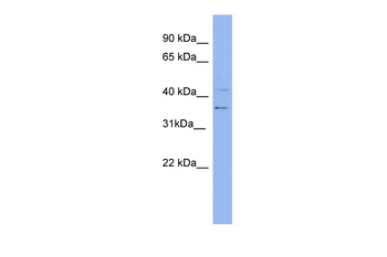 KRT13 Rabbit Polyclonal Antibody