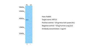 KRT13 Rabbit Polyclonal Antibody