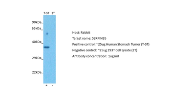 SERPINB5 Rabbit Polyclonal Antibody