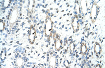 BAG2 Rabbit Polyclonal Antibody