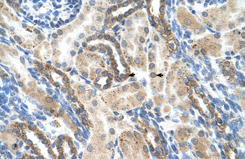 PSG1 Rabbit Polyclonal Antibody