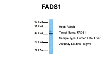 FADS1 Rabbit Polyclonal Antibody