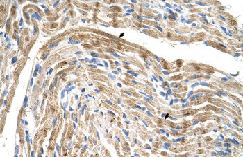 FADS1 Rabbit Polyclonal Antibody