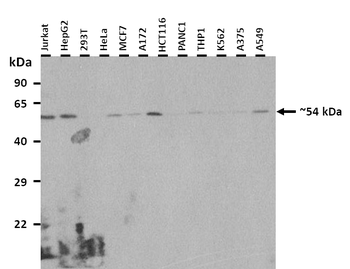 ANGPTL3 Rabbit Polyclonal Antibody