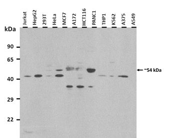 ANGPTL3 Rabbit Polyclonal Antibody