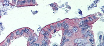 ABHD5 Rabbit Polyclonal Antibody