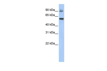 ASCC2 Rabbit Polyclonal Antibody