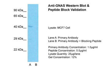 GNAS Rabbit Polyclonal Antibody