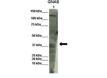 GNAS Rabbit Polyclonal Antibody