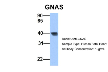GNAS Rabbit Polyclonal Antibody
