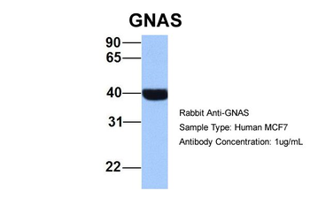 GNAS Rabbit Polyclonal Antibody
