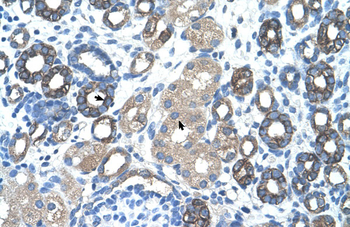 GNAS Rabbit Polyclonal Antibody