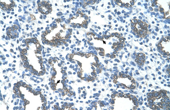 GNAS Rabbit Polyclonal Antibody