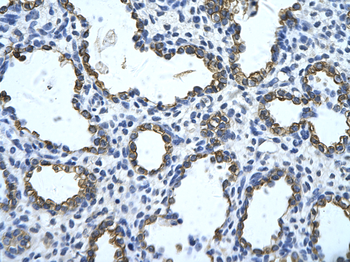 GNAS Rabbit Polyclonal Antibody