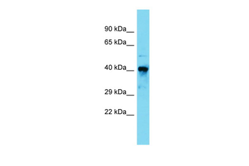 RARA Rabbit Polyclonal Antibody