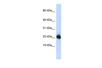 UBE2L3 Rabbit Polyclonal Antibody