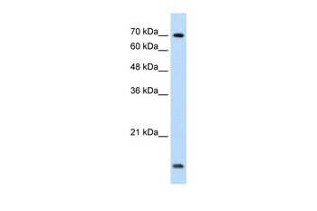 UBE2L3 Rabbit Polyclonal Antibody