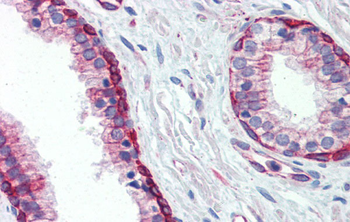 UBE2L3 Rabbit Polyclonal Antibody