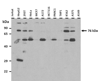 RNF139 Rabbit Polyclonal Antibody
