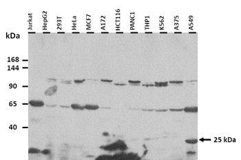NEDD4L Rabbit Polyclonal Antibody
