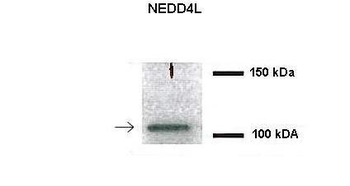 NEDD4L Rabbit Polyclonal Antibody