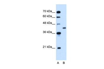 GOT2 Rabbit Polyclonal Antibody