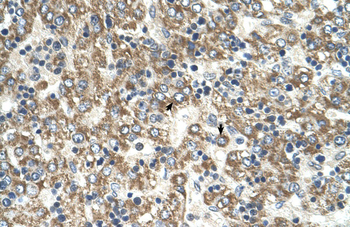 GOT2 Rabbit Polyclonal Antibody