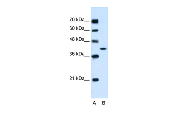 GOT2 Rabbit Polyclonal Antibody