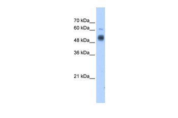 GCNT3 Rabbit Polyclonal Antibody