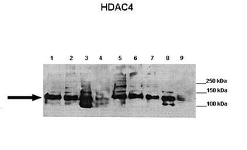 Hdac4 Rabbit Polyclonal Antibody