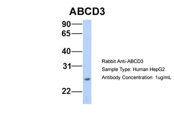 ABCD3 Rabbit Polyclonal Antibody
