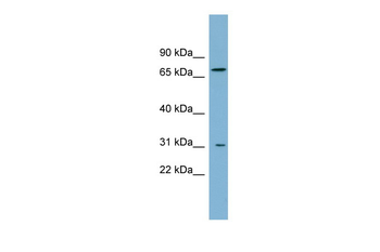 ABCD3 Rabbit Polyclonal Antibody