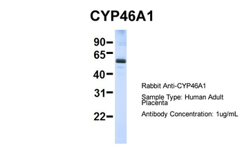 CYP46A1 Rabbit Polyclonal Antibody