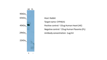 CYP46A1 Rabbit Polyclonal Antibody