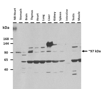 ABCA12 Rabbit Polyclonal Antibody