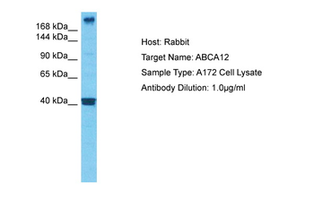 ABCA12 Rabbit Polyclonal Antibody