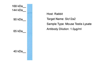 SLC12A2 Rabbit Polyclonal Antibody