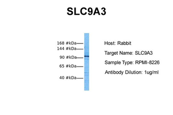 SLC9A3 Rabbit Polyclonal Antibody